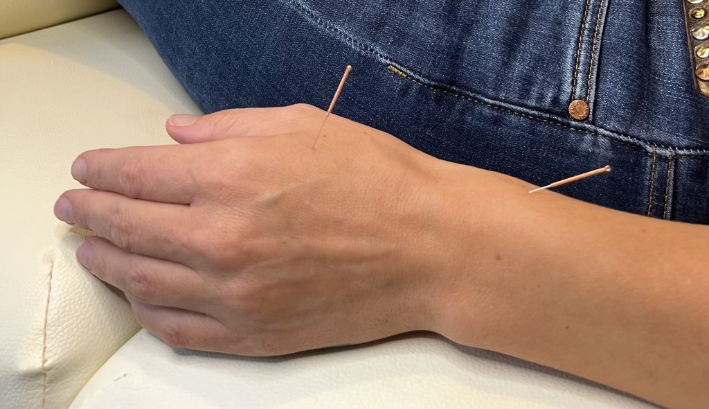 Priser på akupunktur behandling ved Oldenburg Akupunktur  i Aabenraa